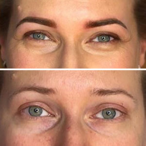 Best Microblading in La